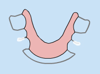 virtual model of a loose appliance