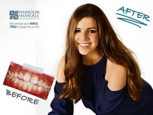 young female patient before and after treatment