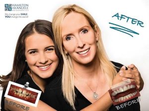 mom and her daughter's smiles before and after treatment