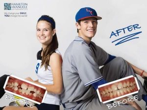 two teen baseball and softball players' smiles before and after treatment
