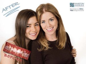 mother and daughter before and after treatment