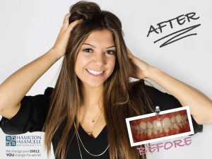 female patient's smile before and after treatment