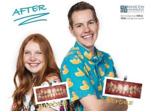 brother and sister's smile before and after treatment