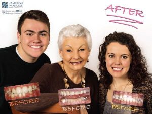 elderly woman and her two grandchildren before and after treatment