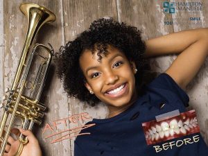 young female trumpet player before and after treatment