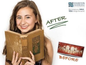 young female patient before and after treatment
