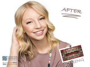 young female patient before and after treatment