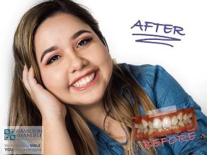 young female patient before and after treatment