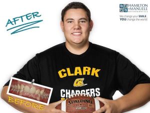 young male football player before and after treatment