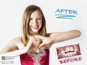young female patient before and after treatment