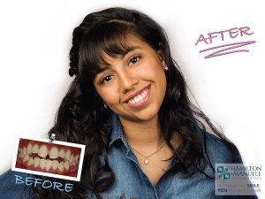 young female patient before and after treatment