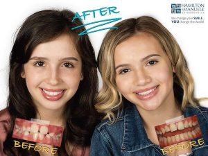 young female patients before and after treatment