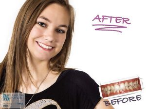 young female patient before and after treatment