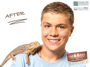 young male patient before and after treatment