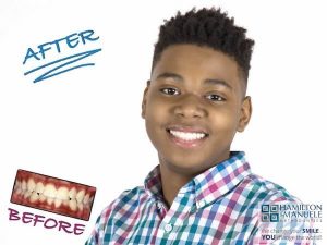 young male patient before and after treatment