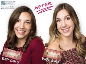 mother and daughter before and after treatment