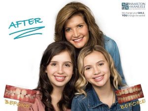 mom and her two daughters before and after treatment