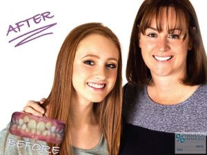 mother and daughter before and after treatment