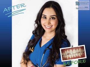 female dental staff member before and after treatment
