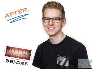 young male patient before and after treatment