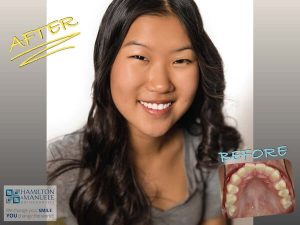 young female patient before and after treatment