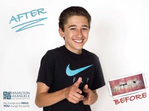 young male patient's smile before and after treatment