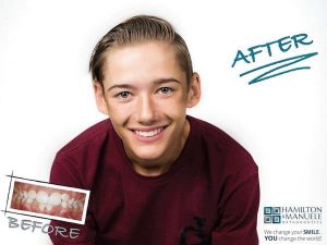young male patient before and after treatment