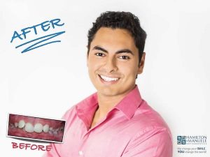 young male patient before and after treatment