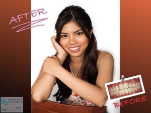 young female patient before and after treatment