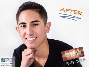 young male patient before and after treatment