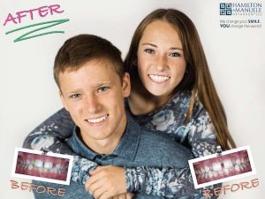 brother and sister's smile before and after treatment