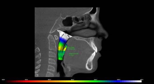 An xray of a good airway